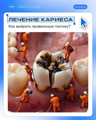 Реминерализирующая терапия: остановите кариес без бормашины.